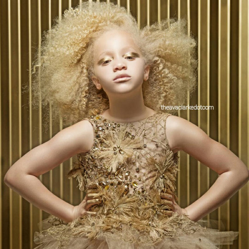 Conhea Ava Clarke, uma linda menina negra com albinismo 08