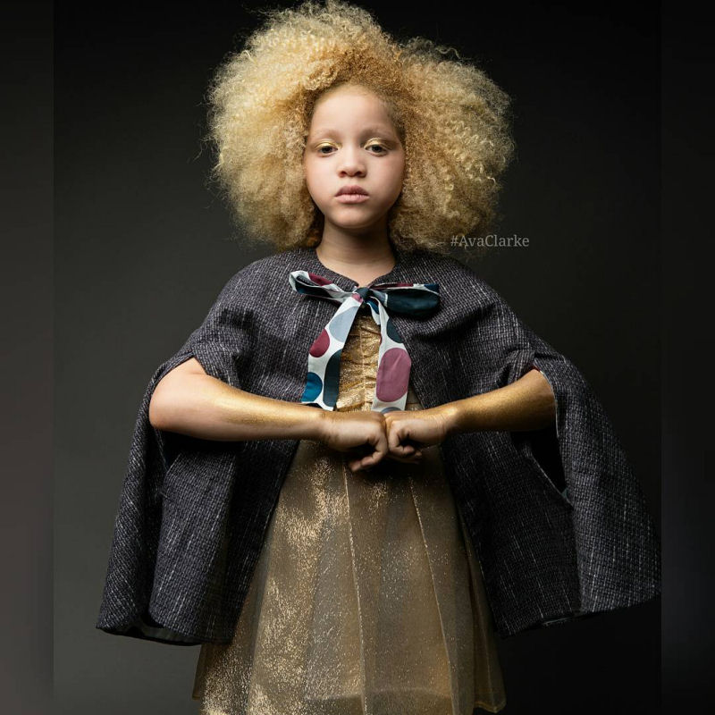 Conhea Ava Clarke, uma linda menina negra com albinismo 09