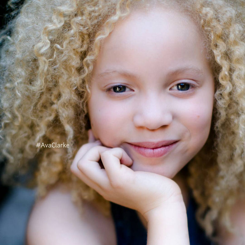 Conhea Ava Clarke, uma linda menina negra com albinismo 12