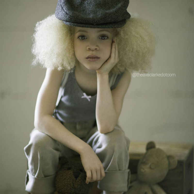 Conhea Ava Clarke, uma linda menina negra com albinismo 13