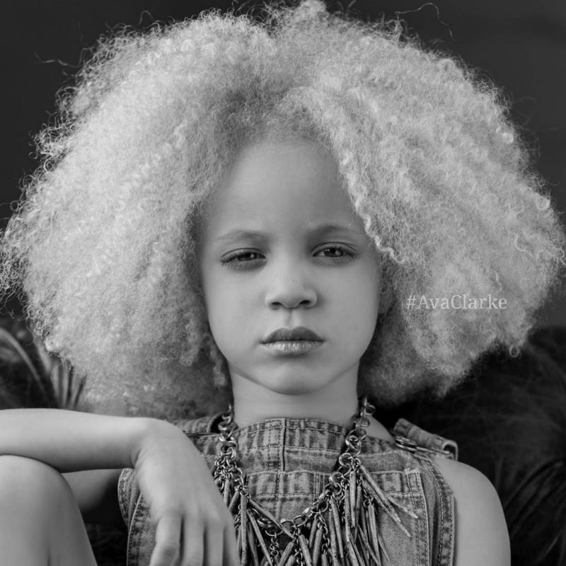 Conhea Ava Clarke, uma linda menina negra com albinismo 14