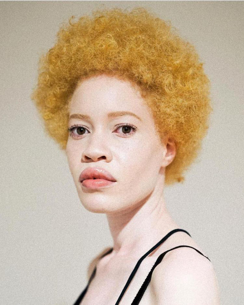 Modelo com albinismo desafia as percepções de beleza na indústria da moda 02