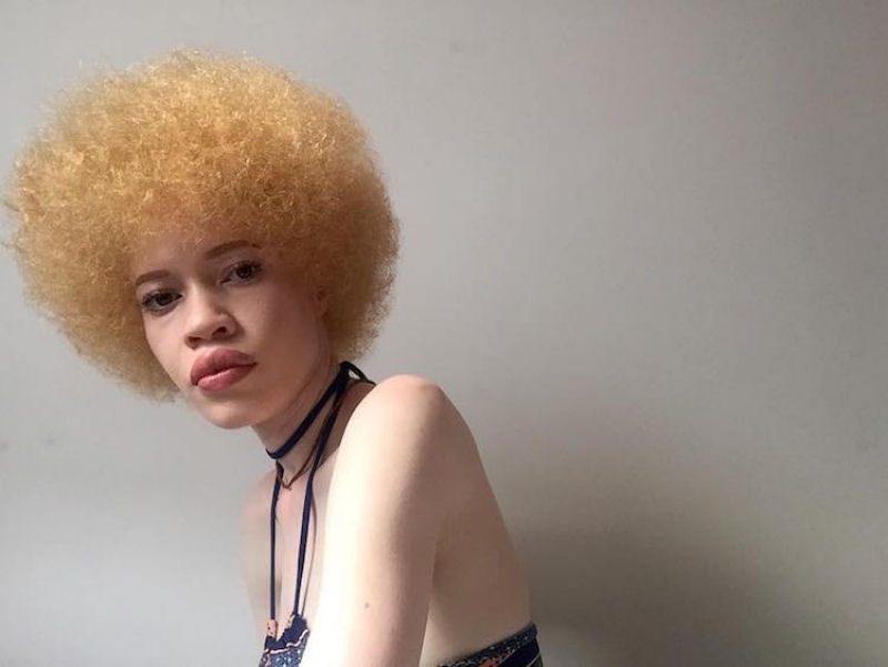 Modelo com albinismo desafia as percepções de beleza na indústria da moda 03
