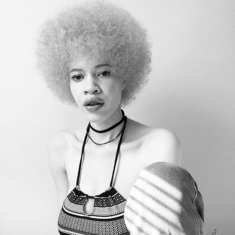 Modelo com albinismo desafia as percepções de beleza na indústria da moda 04