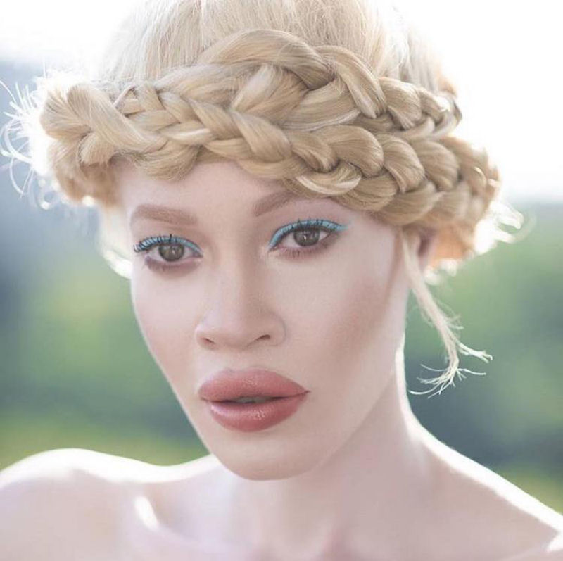 Modelo com albinismo desafia as percepções de beleza na indústria da moda 05