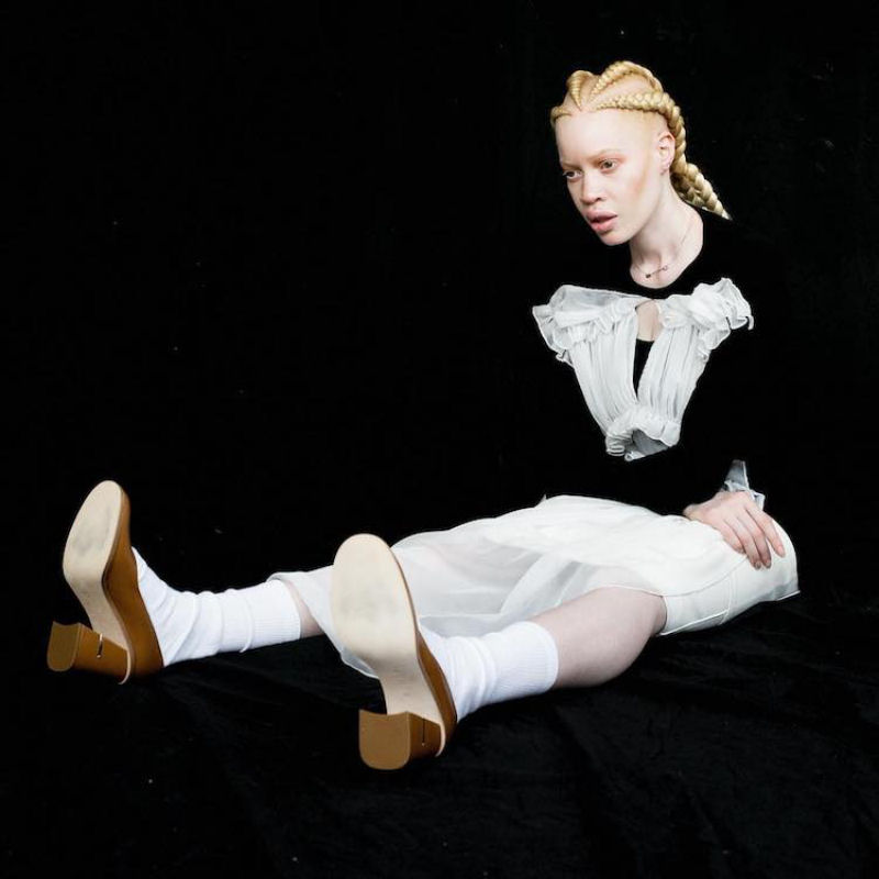 Modelo com albinismo desafia as percepções de beleza na indústria da moda 06