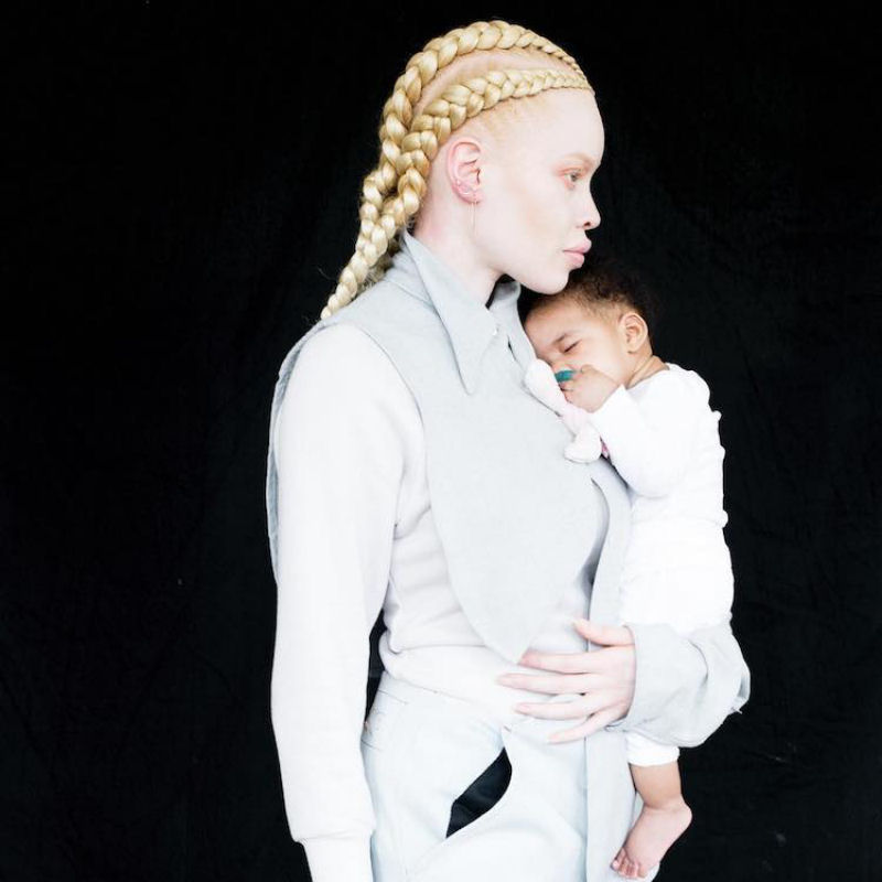 Modelo com albinismo desafia as percepções de beleza na indústria da moda 08