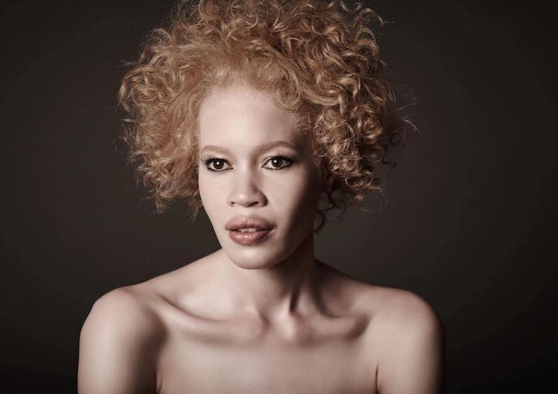 Modelo com albinismo desafia as percepções de beleza na indústria da moda 09
