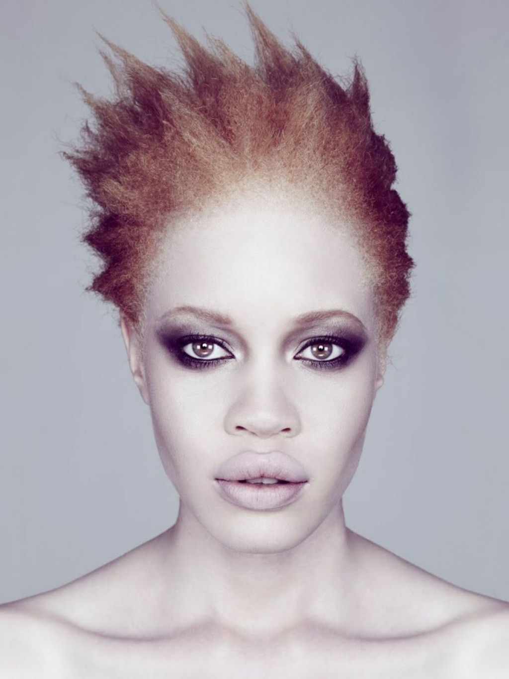 Modelo com albinismo desafia as percepções de beleza na indústria da moda 10