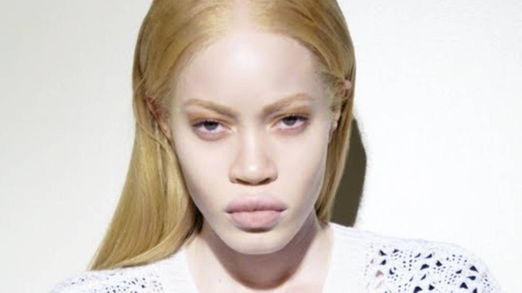 Modelo com albinismo desafia as percepções de beleza na indústria da moda 12