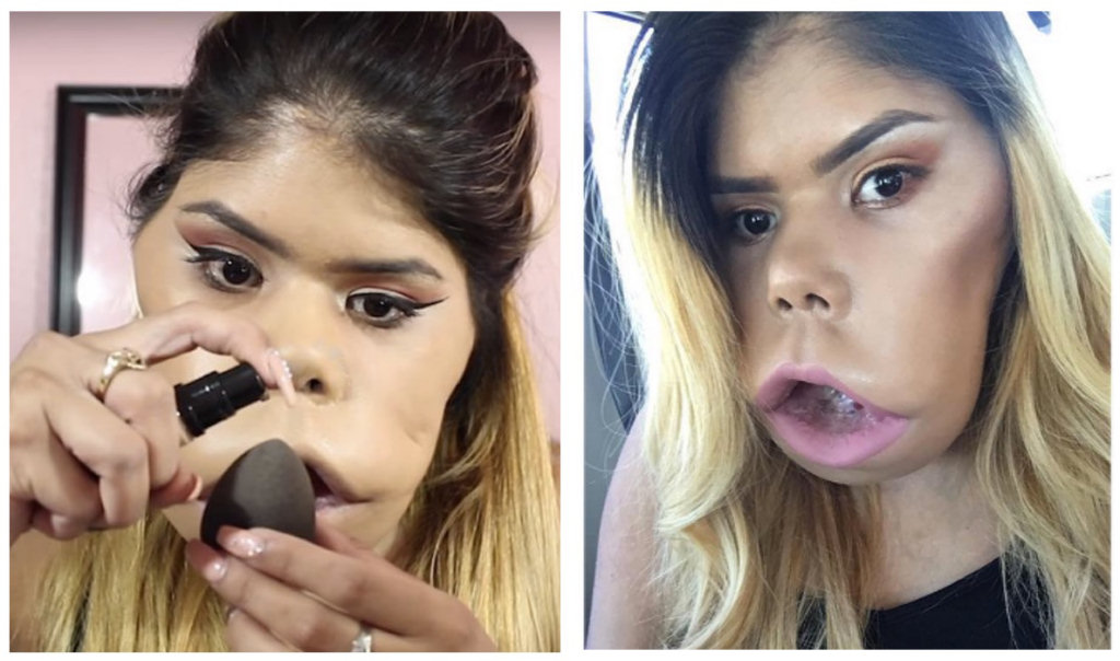 Mulher com estranha doença posta tutoriais de maquiagem na Internet. Nada a intimida!