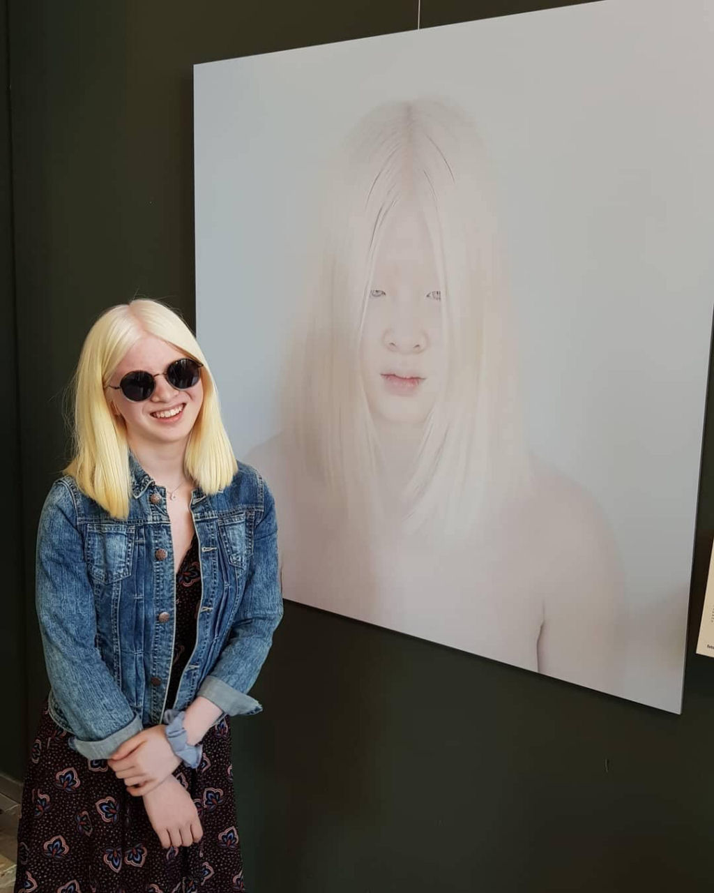 Garota albina abandonada quando criança se tornou modelo da Vogue