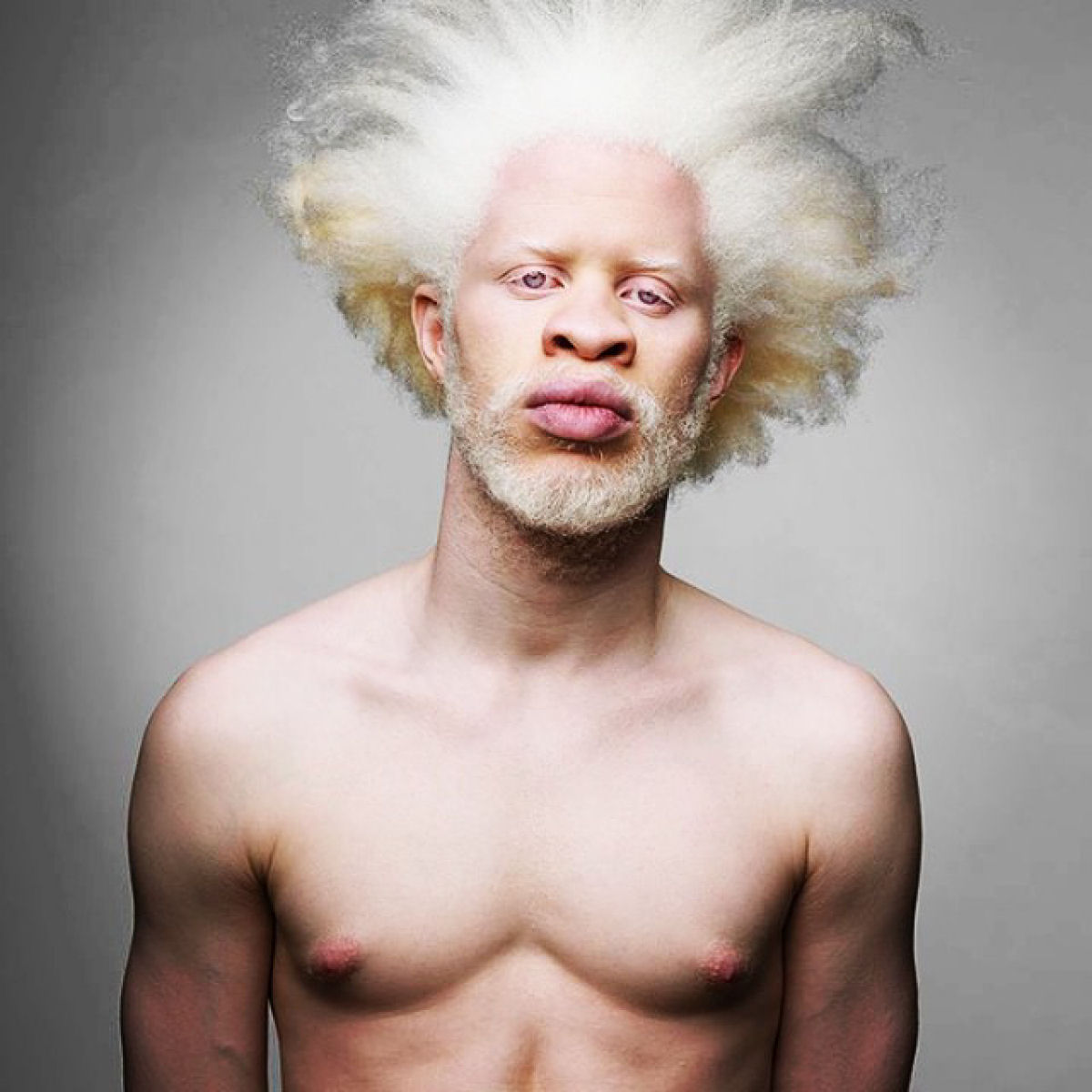 Em alguns lugares do mundo o albinismo  uma verdadeira maldio