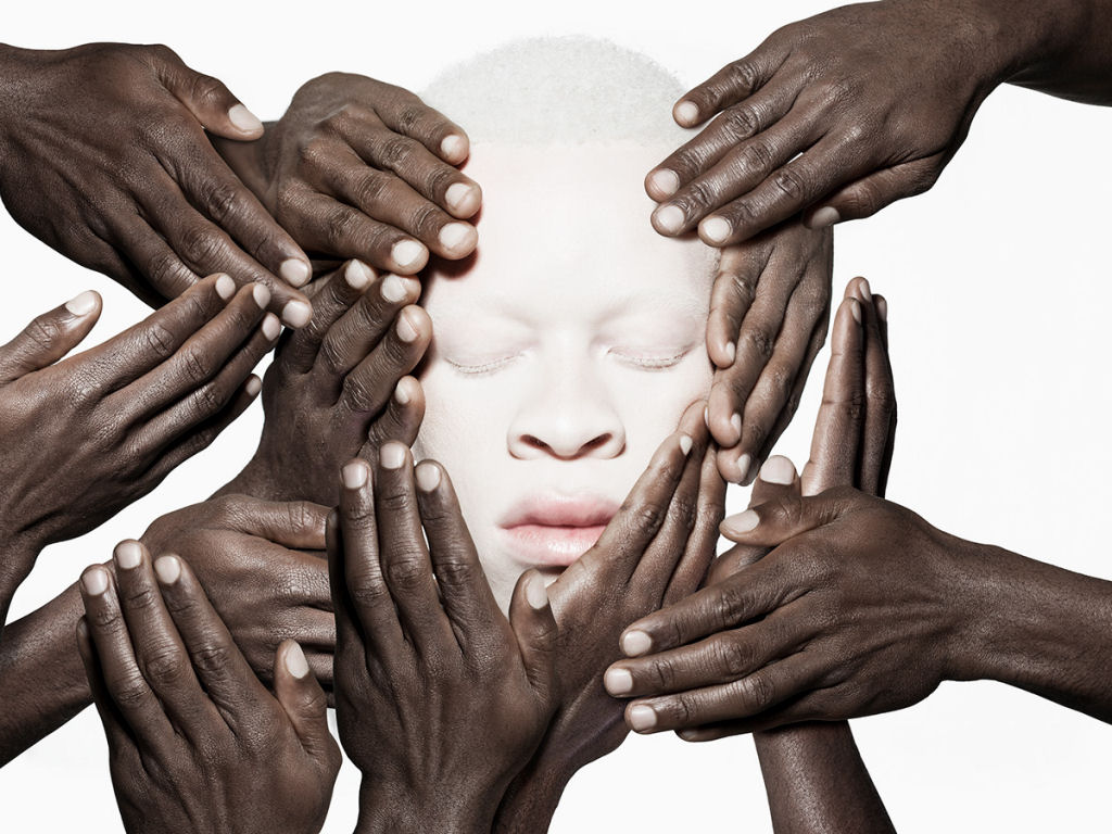 Fotgrafo desafia padres da beleza com modelos albinos 05