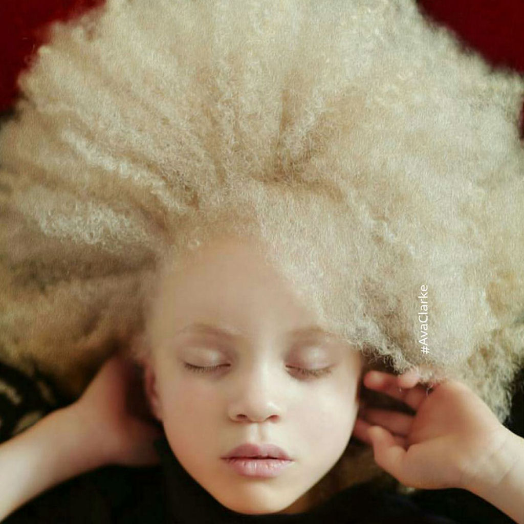 22 pessoas albinas que vo hipnotiz-lo com sua beleza de outro mundo 01