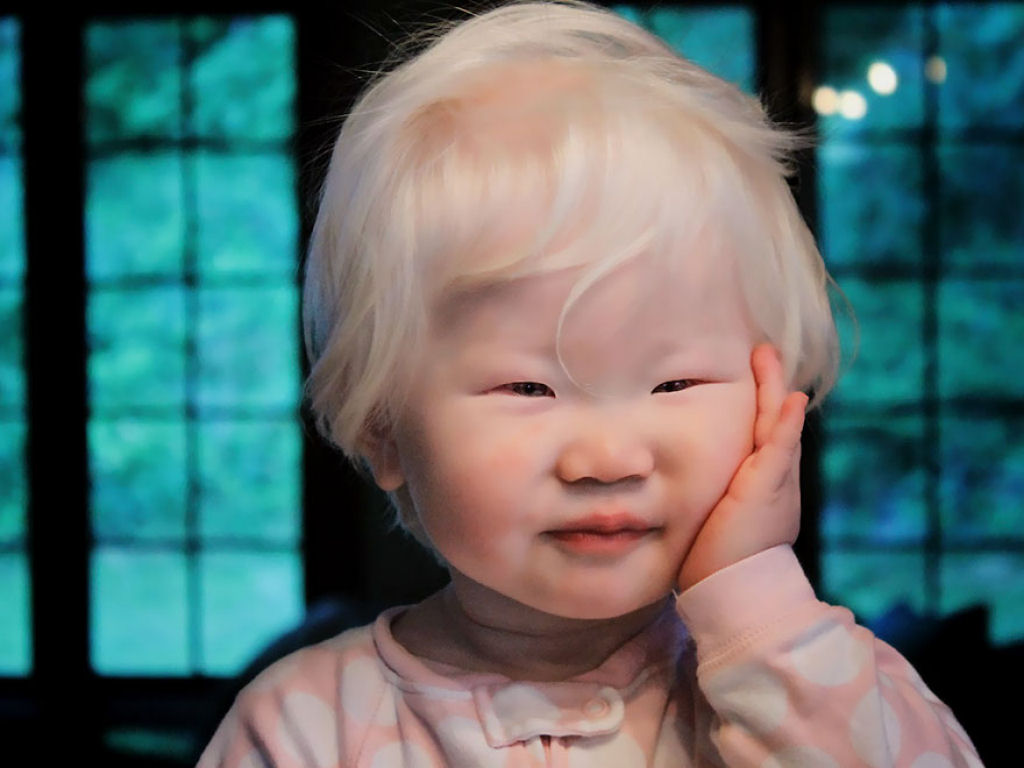 22 pessoas albinas que vo hipnotiz-lo com sua beleza de outro mundo 02