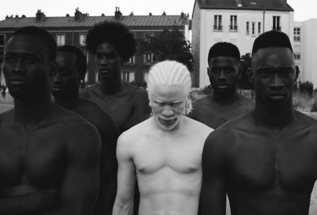 22 pessoas albinas que vo hipnotiz-lo com sua beleza de outro mundo 03