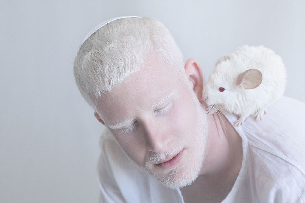 22 pessoas albinas que vo hipnotiz-lo com sua beleza de outro mundo 06