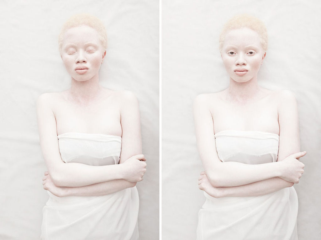 22 pessoas albinas que vo hipnotiz-lo com sua beleza de outro mundo 07