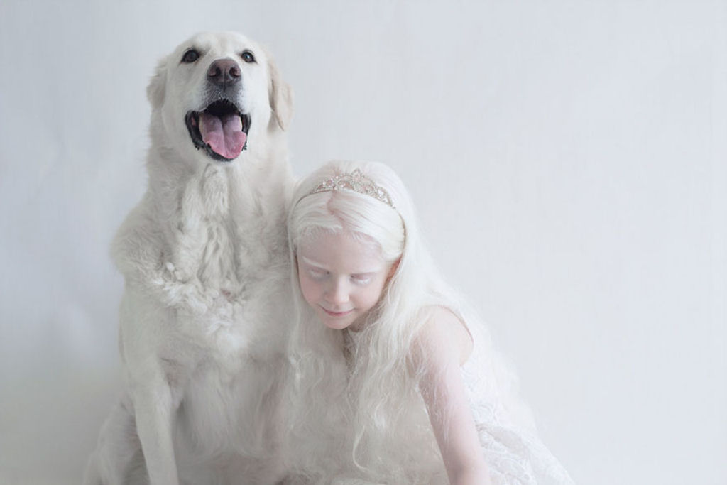 22 pessoas albinas que vo hipnotiz-lo com sua beleza de outro mundo 08