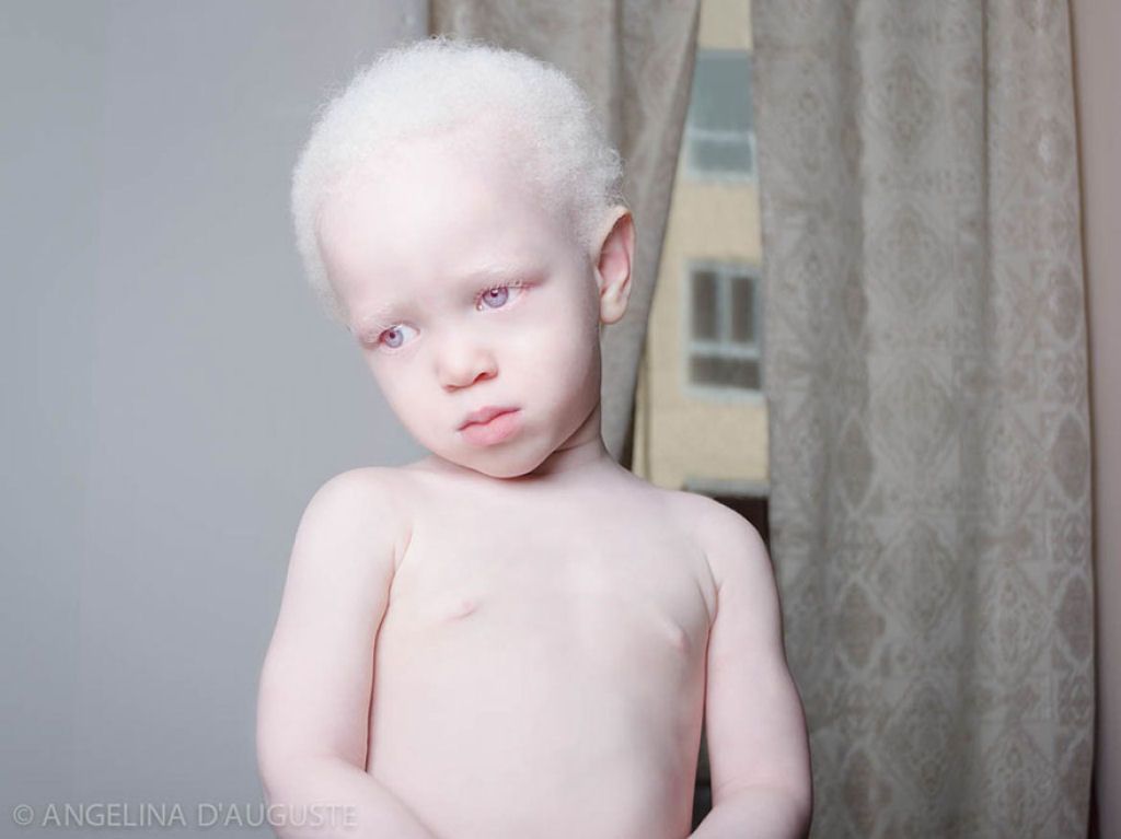 22 pessoas albinas que vo hipnotiz-lo com sua beleza de outro mundo 10