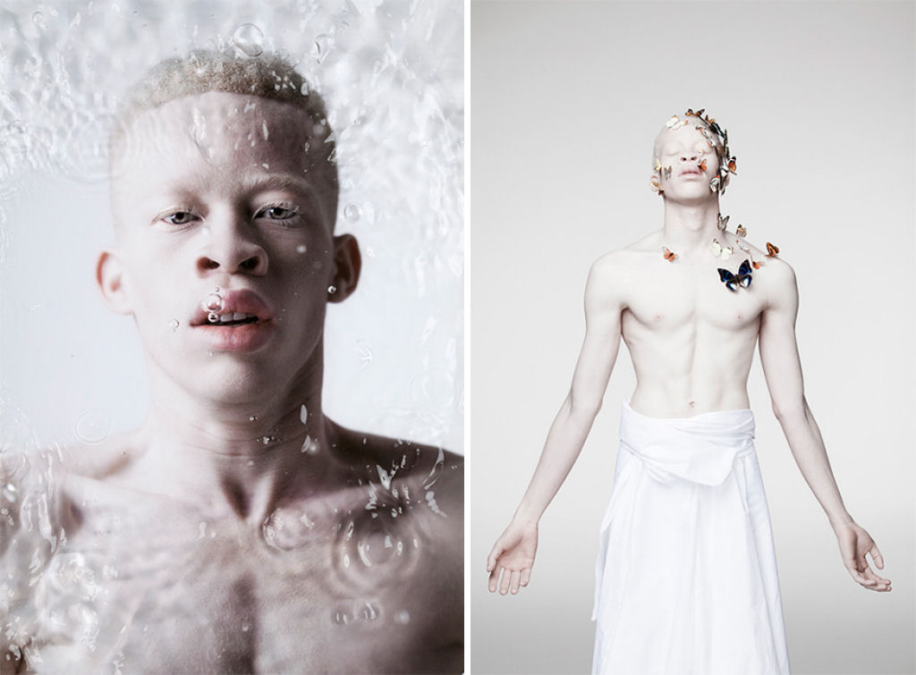 22 pessoas albinas que vo hipnotiz-lo com sua beleza de outro mundo 11