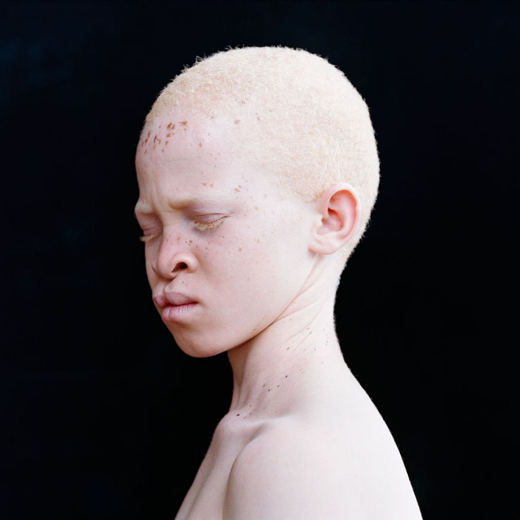 22 pessoas albinas que vo hipnotiz-lo com sua beleza de outro mundo 12