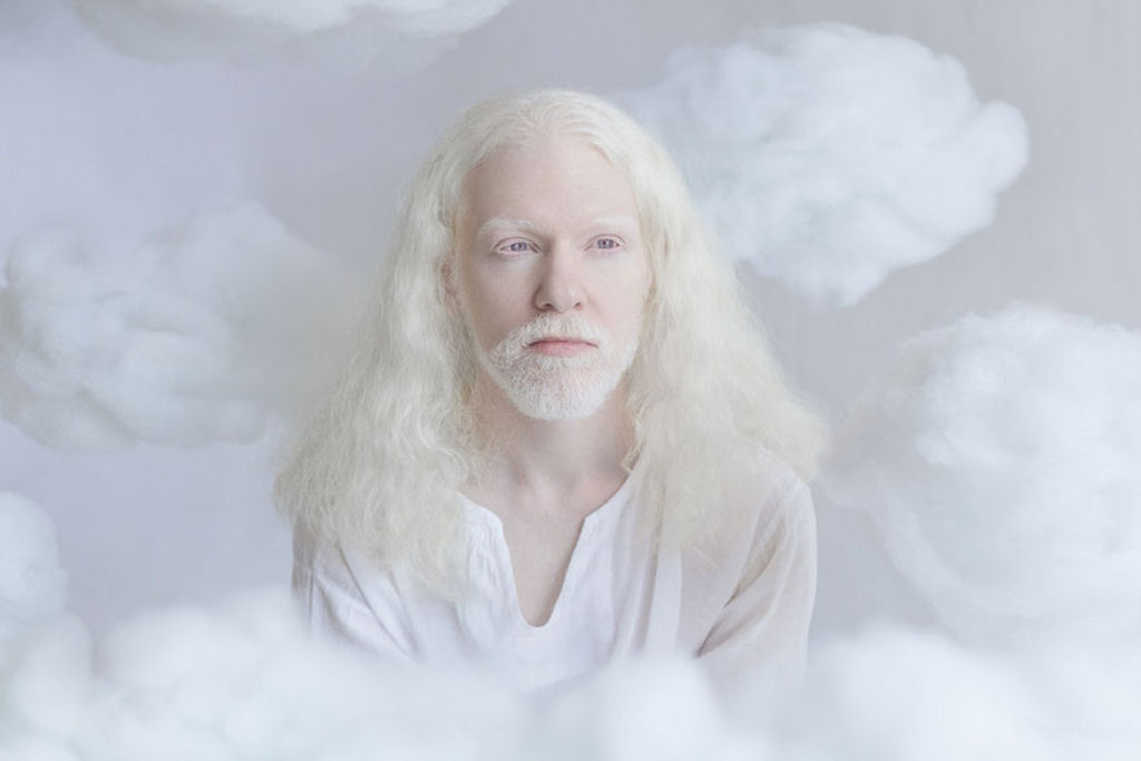 22 pessoas albinas que vo hipnotiz-lo com sua beleza de outro mundo 13