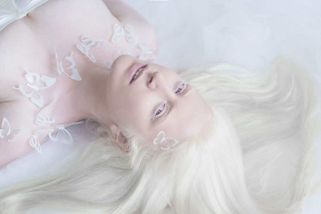 22 pessoas albinas que vo hipnotiz-lo com sua beleza de outro mundo 14