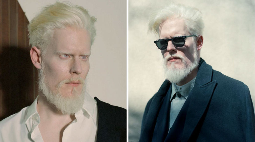 22 pessoas albinas que vo hipnotiz-lo com sua beleza de outro mundo 15