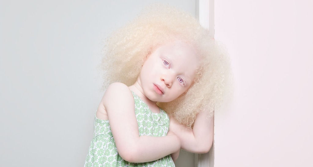 22 pessoas albinas que vo hipnotiz-lo com sua beleza de outro mundo 17