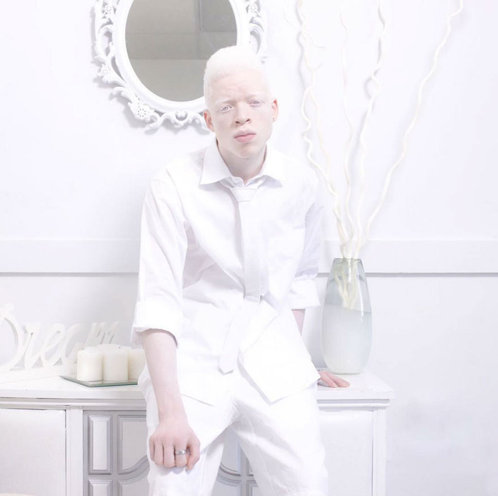 22 pessoas albinas que vo hipnotiz-lo com sua beleza de outro mundo 19