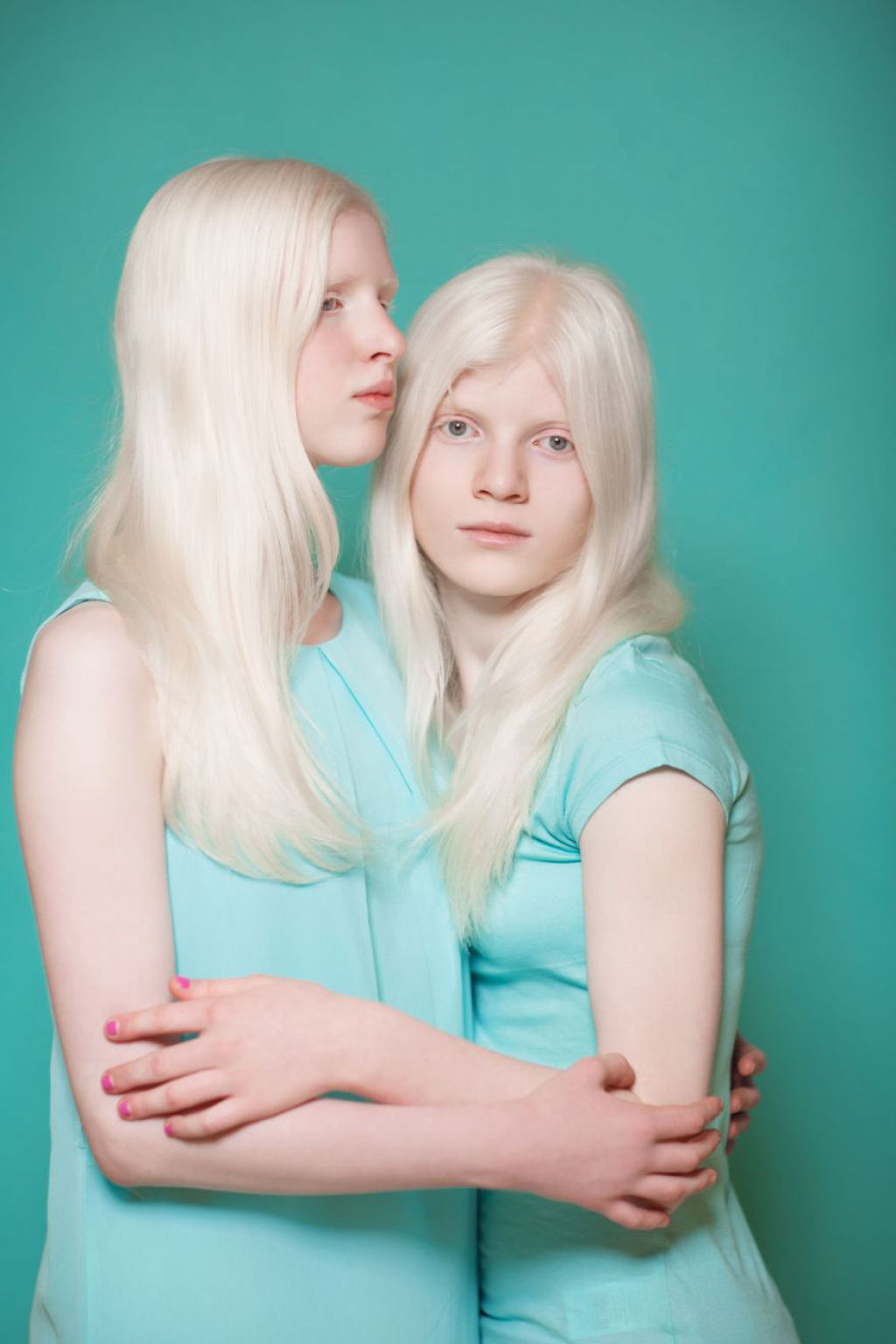 22 pessoas albinas que vo hipnotiz-lo com sua beleza de outro mundo 21