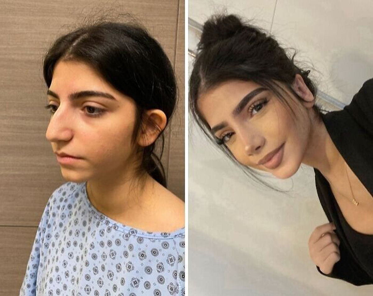 A origem da express�o 'cirurgia pl�stica' � bem mais complicada do que pensamos