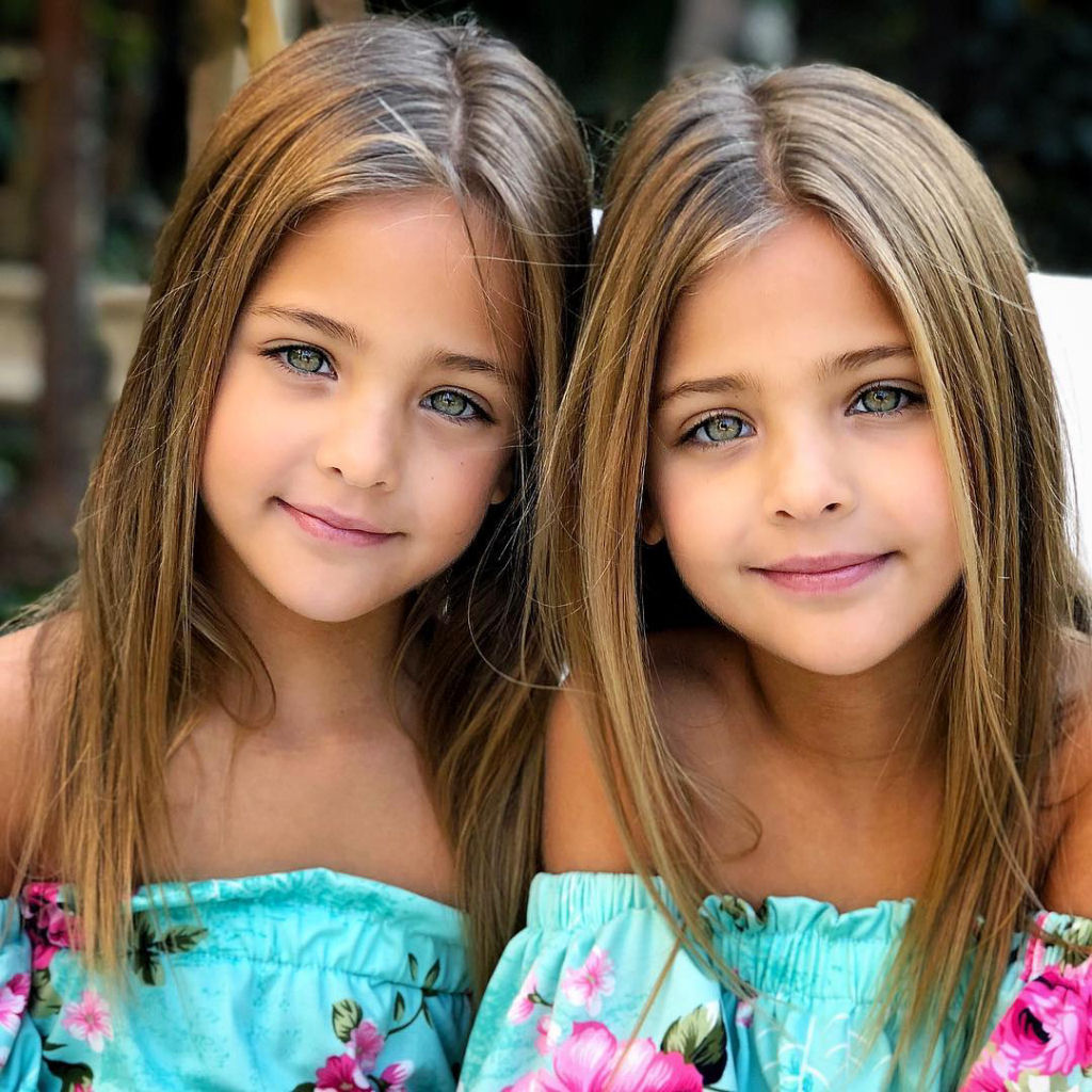 Conheça as irmãs consideradas as «gêmeas mais belas do mundo» 13