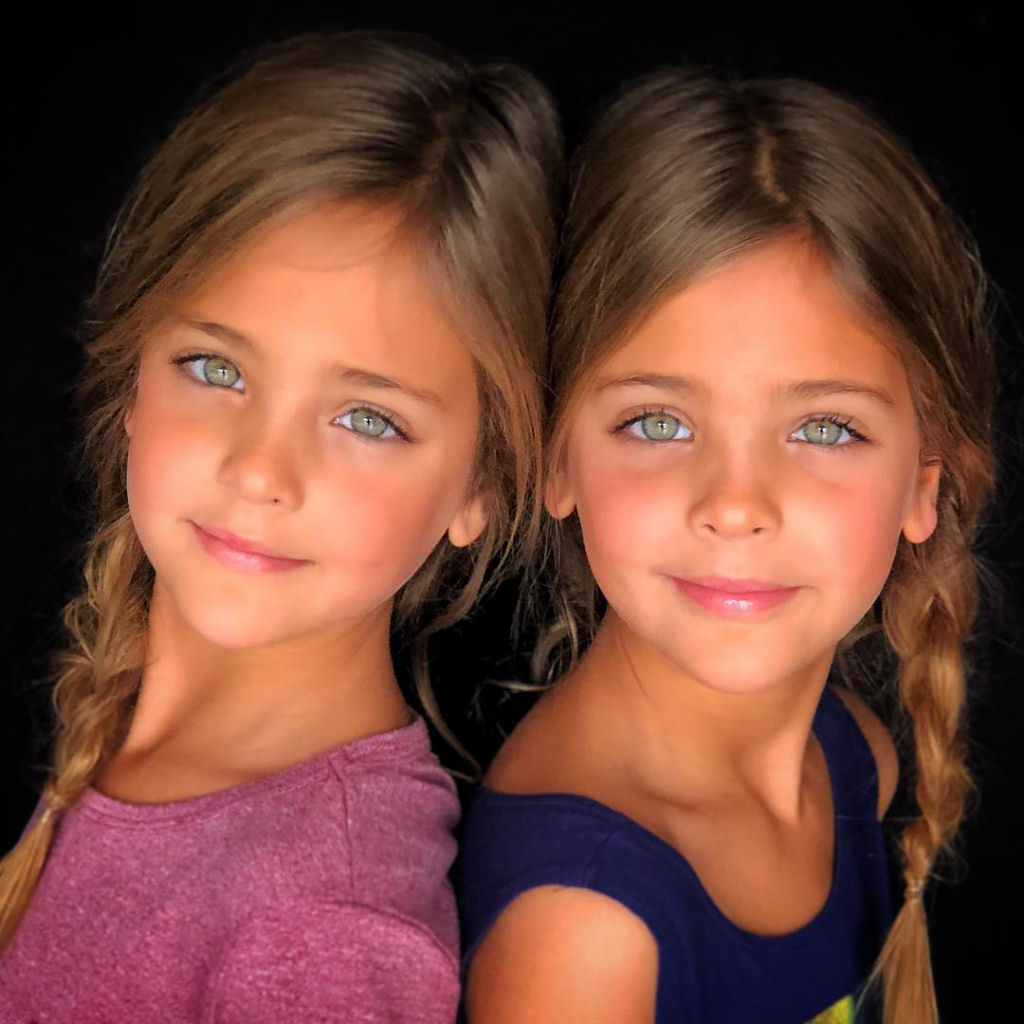 Conheça as irmãs consideradas as «gêmeas mais belas do mundo» 14