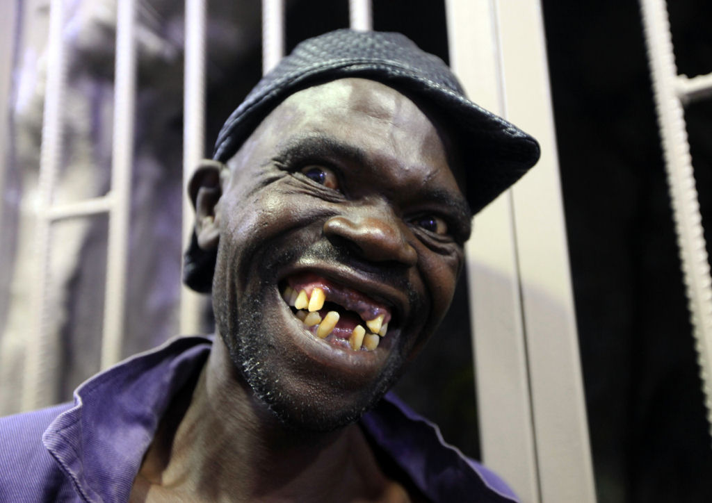 O homem «mais feio» do Zimbábue está orgulhoso de ganhar o título pela 4ª vez 04