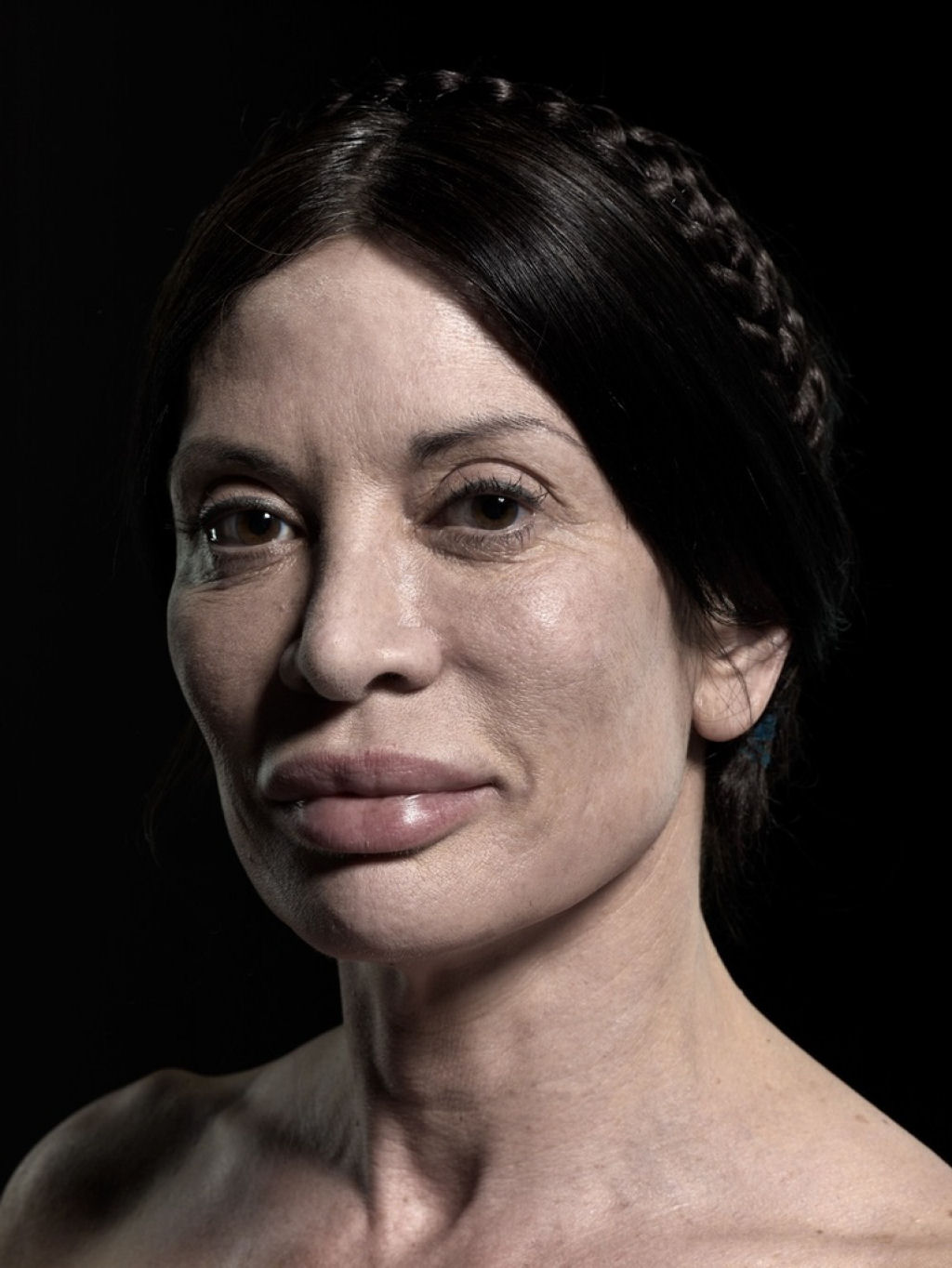 Plstica beleza: retratos de pessoas com cirurgia esttica extrema 03