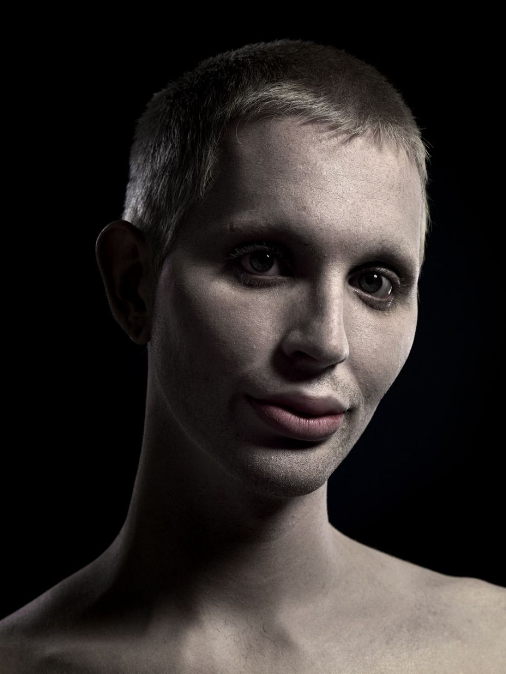 Plstica beleza: retratos de pessoas com cirurgia esttica extrema 10