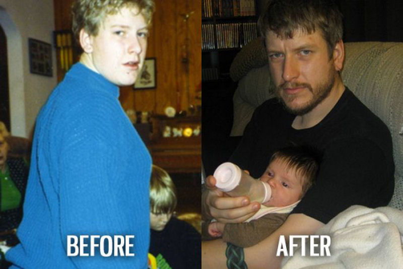 Antes e depois de pessoas com síndrome do patinho feio 07
