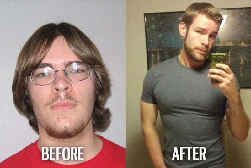 Antes e depois de pessoas com síndrome do patinho feio 09