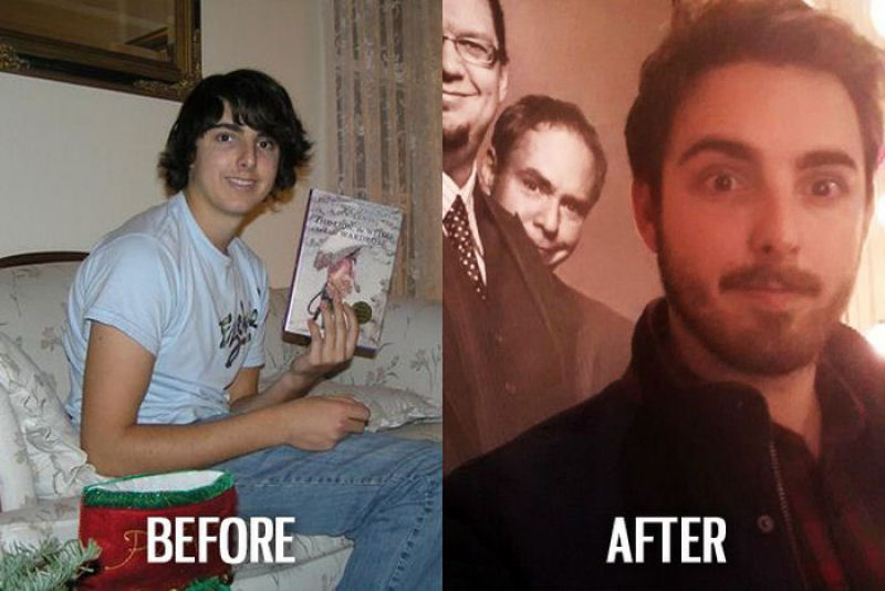 Antes e depois de pessoas com síndrome do patinho feio 13