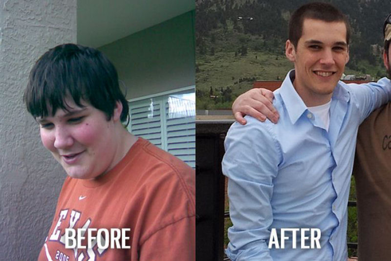 Antes e depois de pessoas com síndrome do patinho feio 29