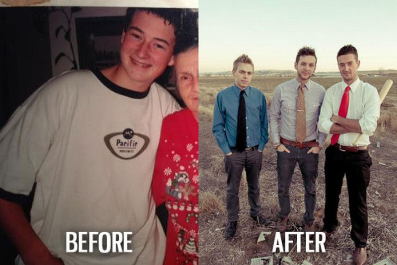 Antes e depois de pessoas com síndrome do patinho feio 30