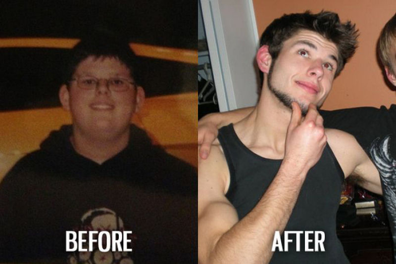 Antes e depois de pessoas com síndrome do patinho feio 36