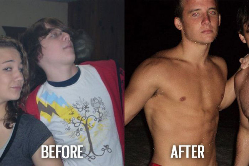 Antes e depois de pessoas com síndrome do patinho feio 37