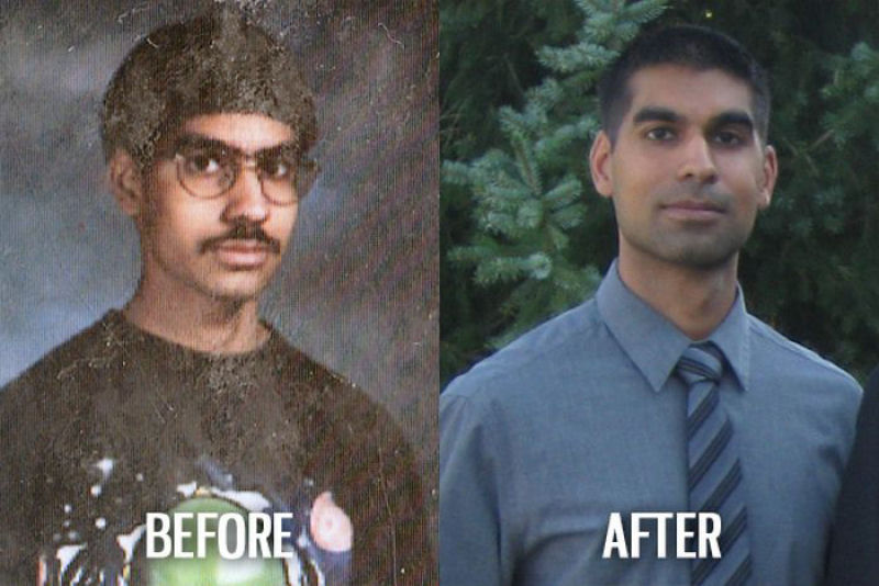Antes e depois de pessoas com síndrome do patinho feio 40