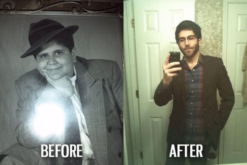 Antes e depois de pessoas com síndrome do patinho feio 42