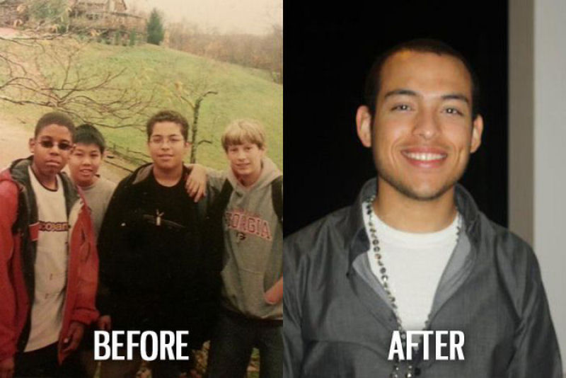 Antes e depois de pessoas com síndrome do patinho feio 46
