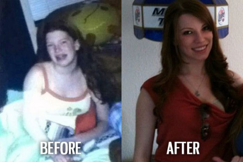 Antes e depois de pessoas com síndrome do patinho feio 53